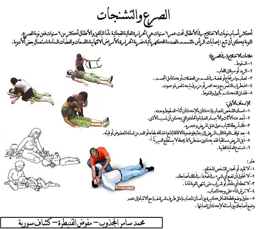 اسباب مرض الصرع - ما هي اعراض مرض الصرع - 4702 3