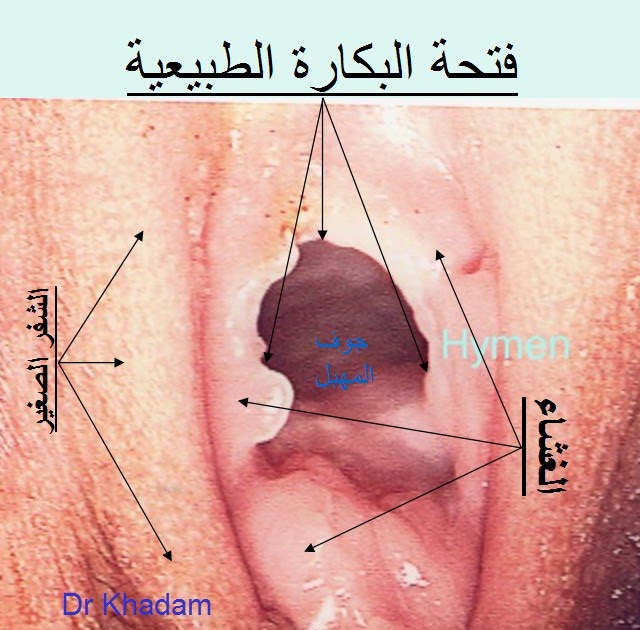 حجم فتحة المهبل الطبيعي- لضمان السعادة الجنسية عليكي بالتالي 4900 1