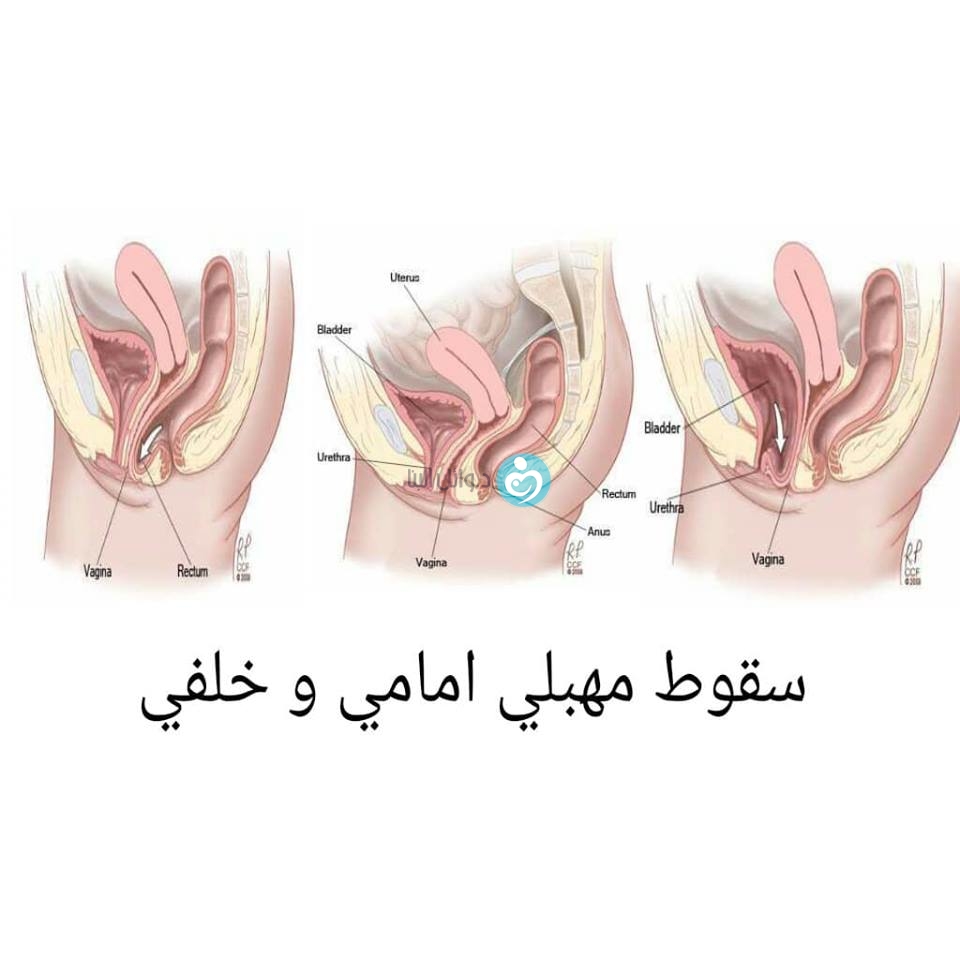 حجم فتحة المهبل الطبيعي- لضمان السعادة الجنسية عليكي بالتالي 4900 8