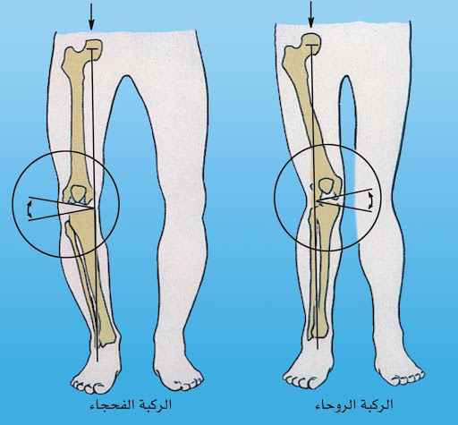 اصابات الركبة بالصور 386 2