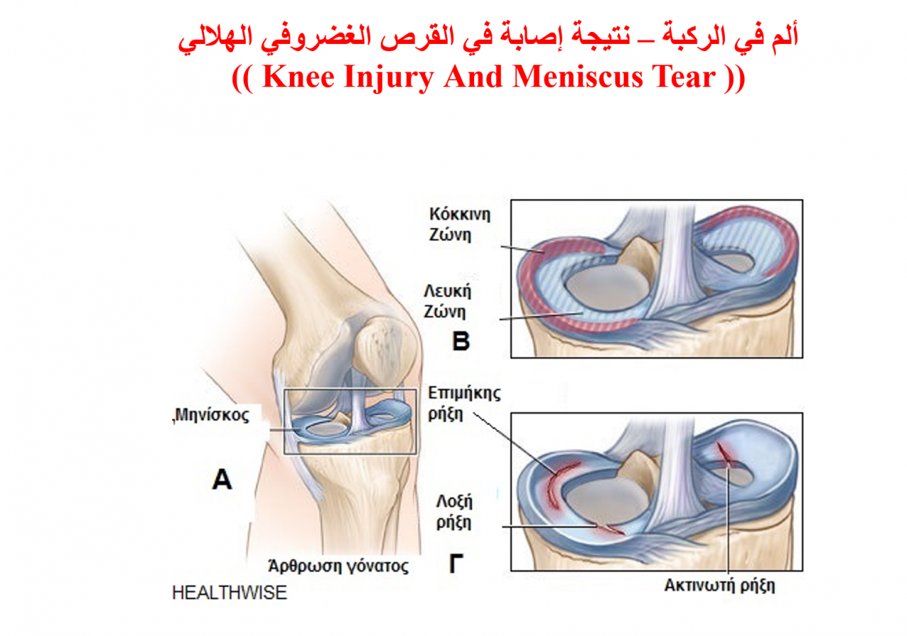 اصابات الركبة بالصور 386 2