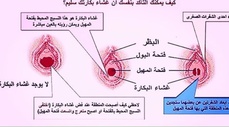 حجم فتحة المهبل الطبيعي- لضمان السعادة الجنسية عليكي بالتالي 4900 7