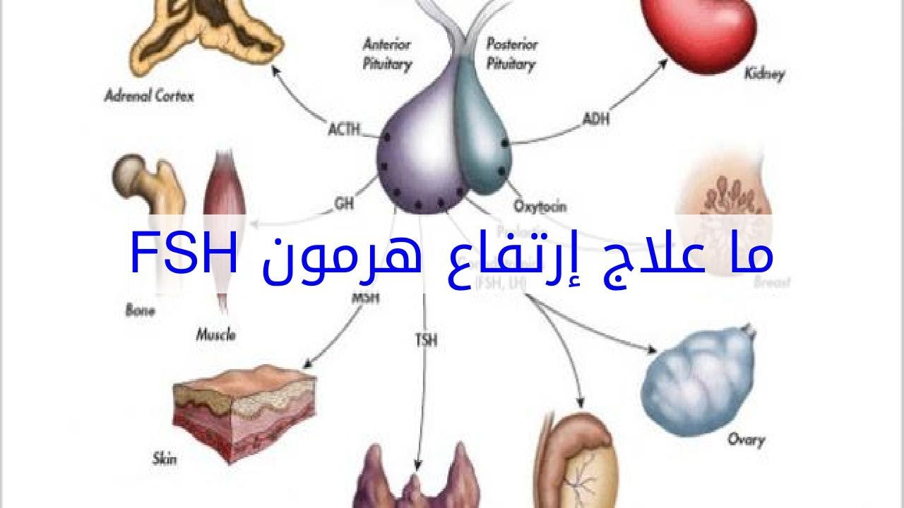 علاج ارتفاع هرمون Fsh 226 1