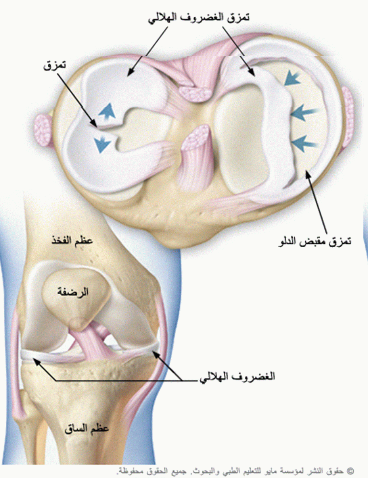 اصابات الركبة بالصور 386